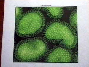 Чем ближе зима, тем реже свежие фрукты и овощи попадают…