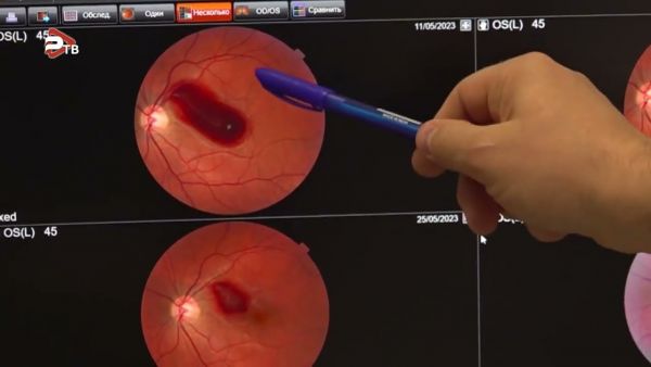 Мама двоих детей Мария Соколова никогда не жаловалась на зрение.